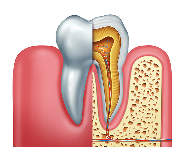 Root Canals St Helena